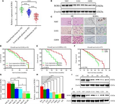 The EIF4A3/CASC2/RORA Feedback Loop Regulates the Aggressive Phenotype in Glioblastomas